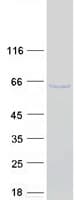 Human IRF5 Protein (Recombinant Myc-DDK (Flag))