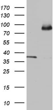 Monoclonal Mouse anti-Human ALDP / ABCD1 Antibody (clone OTI5G6, aa508-745, IHC, WB)