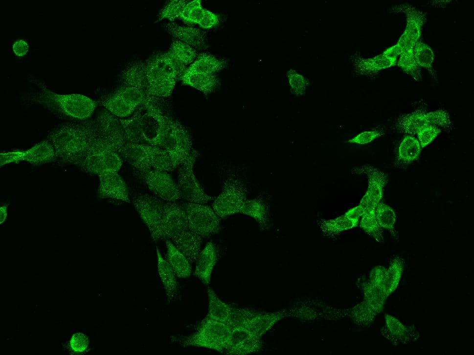 SSR3 / TRAP-Gamma Antibody