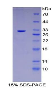 Human CHEK2 / CHK2 Protein (Recombinant His-T7)