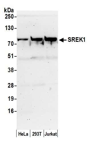 SREK1 / SRRP86 Antibody (aa458-508)