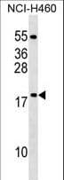 MRPL54 Antibody (aa64-92)