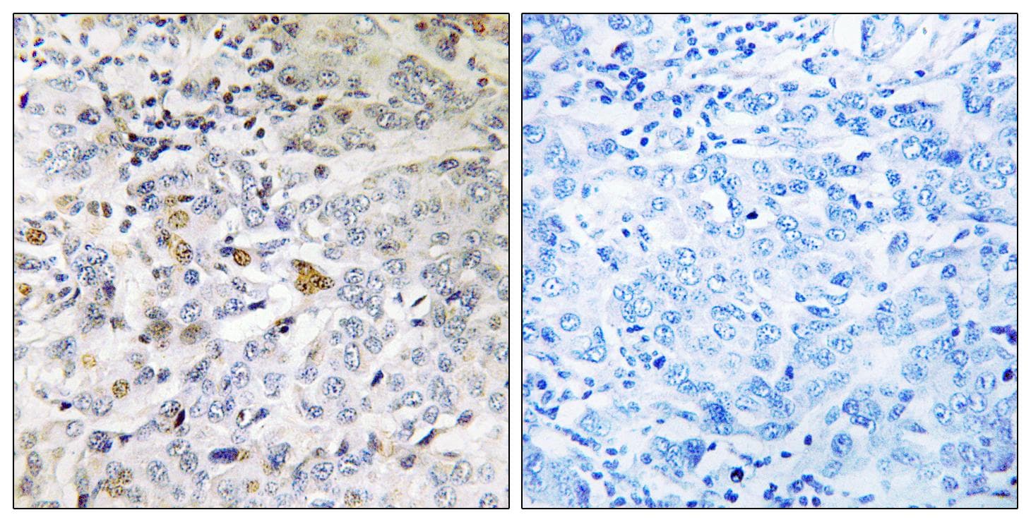 IFT22 / RABL5 Antibody