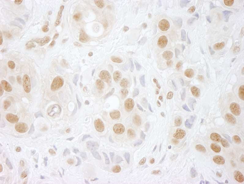 PRPF3 Antibody (aa100-150)