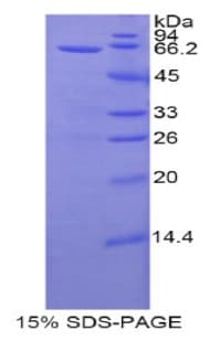 Human PPL / Periplakin Protein (Recombinant His-GST)