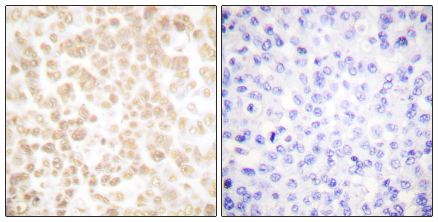 FOSL2 / FRA-2 Antibody (aa271-320)