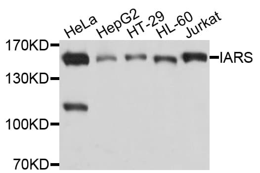 Polyclonal Rabbit anti-Human IRS Antibody (WB)