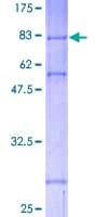 Human CHEK1 / CHK1 Protein (Recombinant GST)