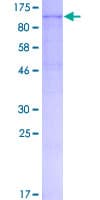 Human ENPP1 Protein (Recombinant GST)
