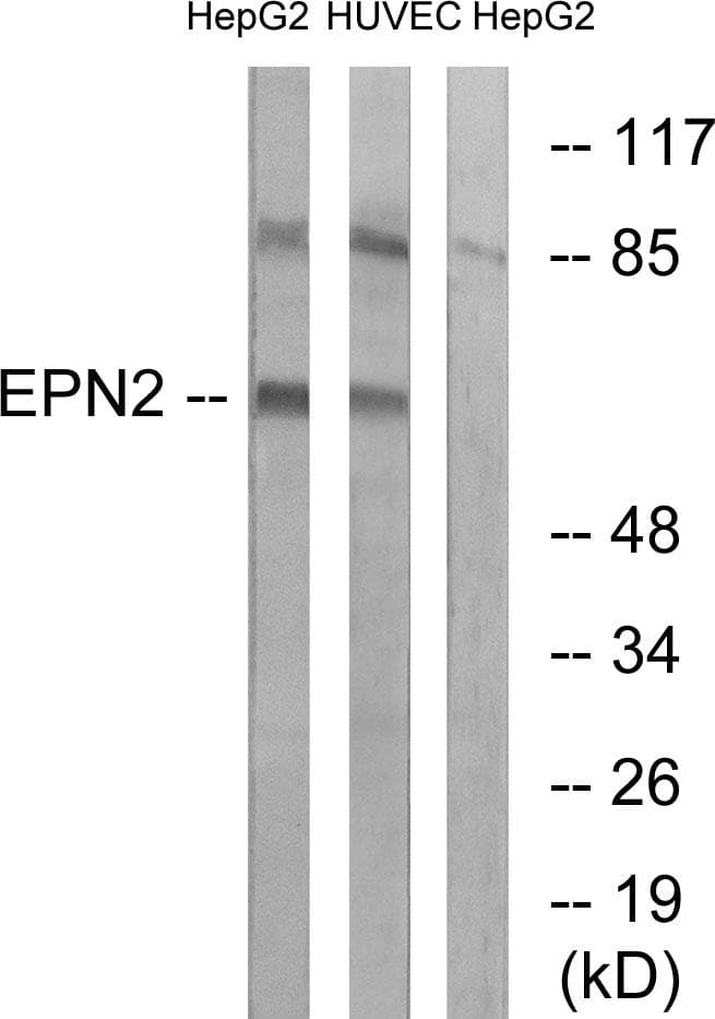 Polyclonal Rabbit anti-Human EPN2 Antibody (WB)