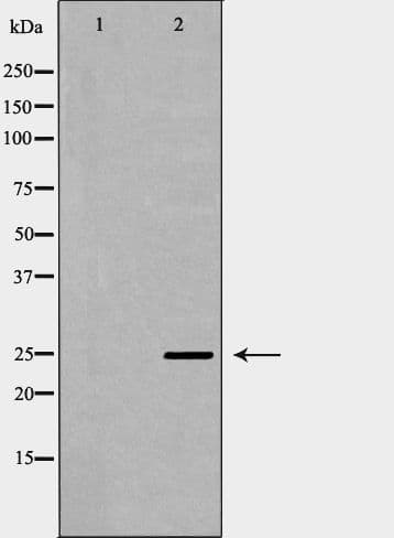 SOCS3 Antibody