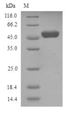 Human WT1 / Wilms Tumor 1 Protein (Recombinant 6His, N-terminus)