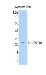 PECAM-1 / CD31 Antibody (aa226-389)