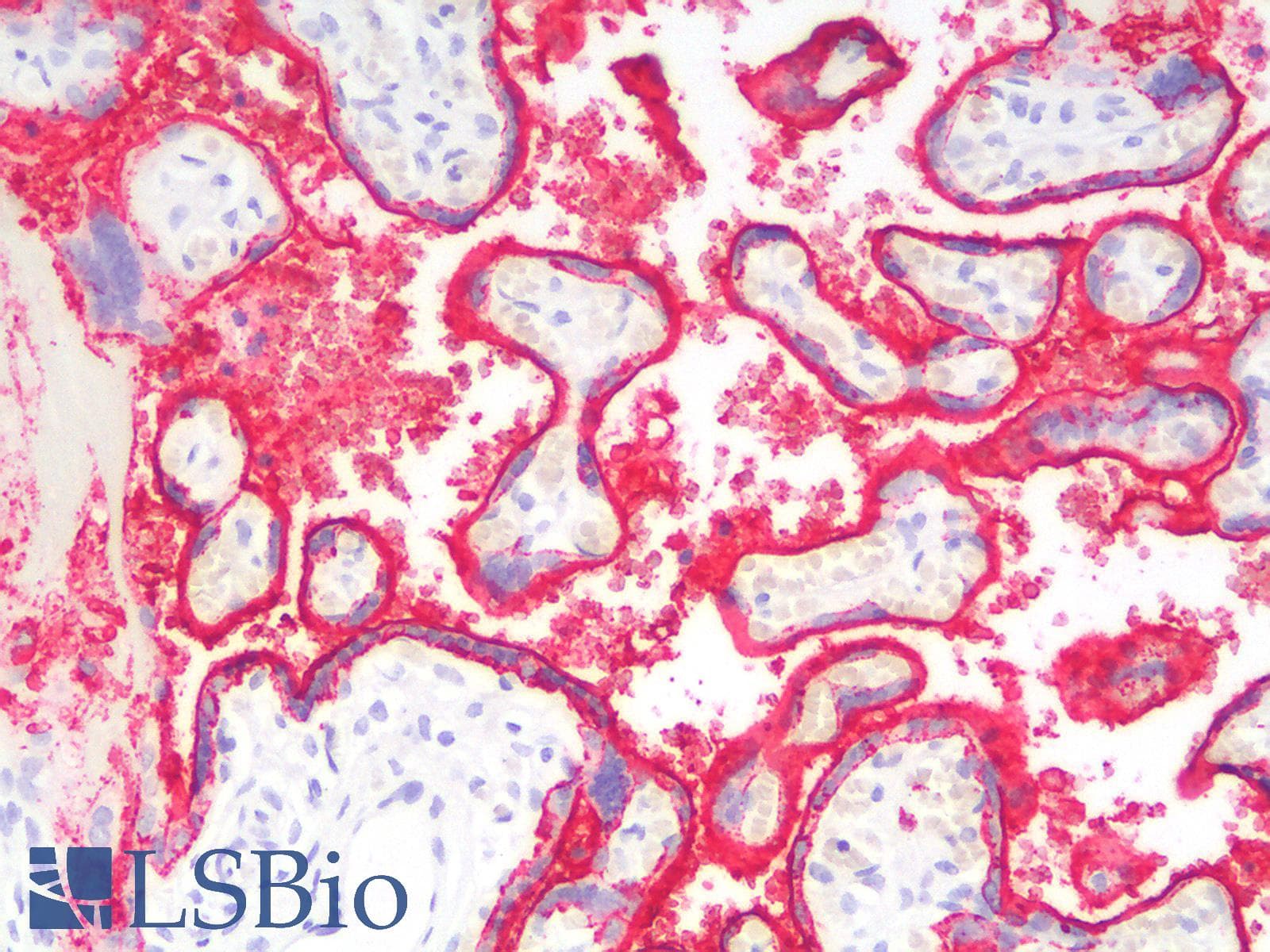 PathPlus™ PLAP / Alkaline Phosphatase Antibody (clone ALPP/2899R)