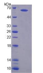 Human GRIN2A / NMDAR2A / NR2A Protein (Recombinant 6His, N-terminus)