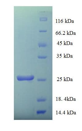 Rat PRNP / PrP / Prion Protein (Recombinant His)