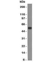 EPCAM Antibody (clone SPM534)