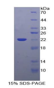 Bovine IL-10 Protein (Recombinant His-T7)