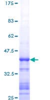 Human MDM2 Protein (Recombinant GST, N-terminus)