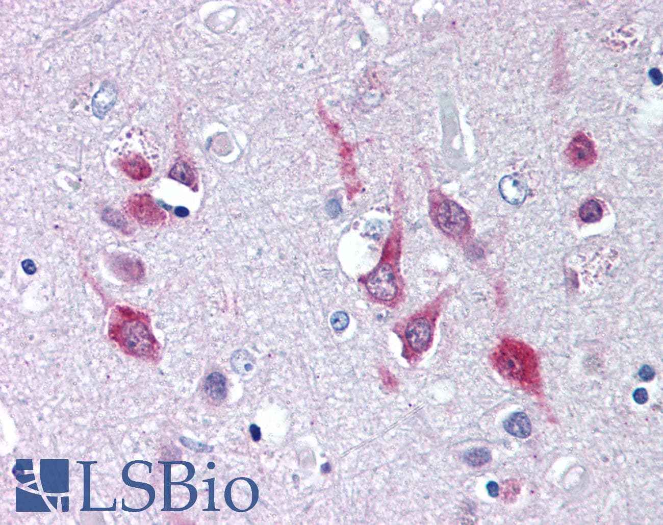 IHC-plus™ CACNA1C / Cav1.2 Antibody (C-Terminus)
