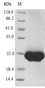 Human CXCR4 Protein (Recombinant 10His-SUMO, N-terminus + Myc, C-terminus)