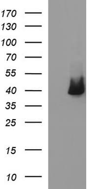 SERPINB3 Antibody (clone OTI3G4)