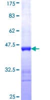 Human ICA69 / ICA1 Protein (Recombinant GST, N-terminus)