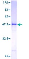Human UBE2E2 / UBCH8 Protein (Recombinant GST)