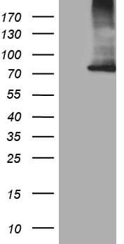 CPT1B Antibody (aa187-440, clone OTI2A6)