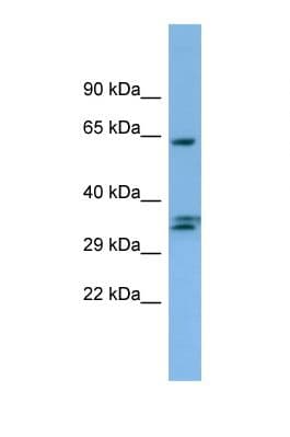 Polyclonal Rabbit anti-Human NRBP1 / NRBP Antibody (C-Terminus, WB)
