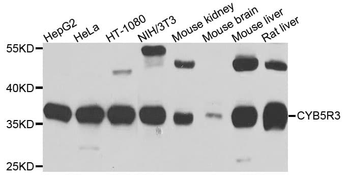 Polyclonal Rabbit anti-Human CYB5R3 / B5R Antibody (WB)