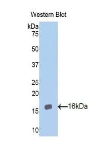 ACAN / Aggrecan Antibody (aa34-147, PE)
