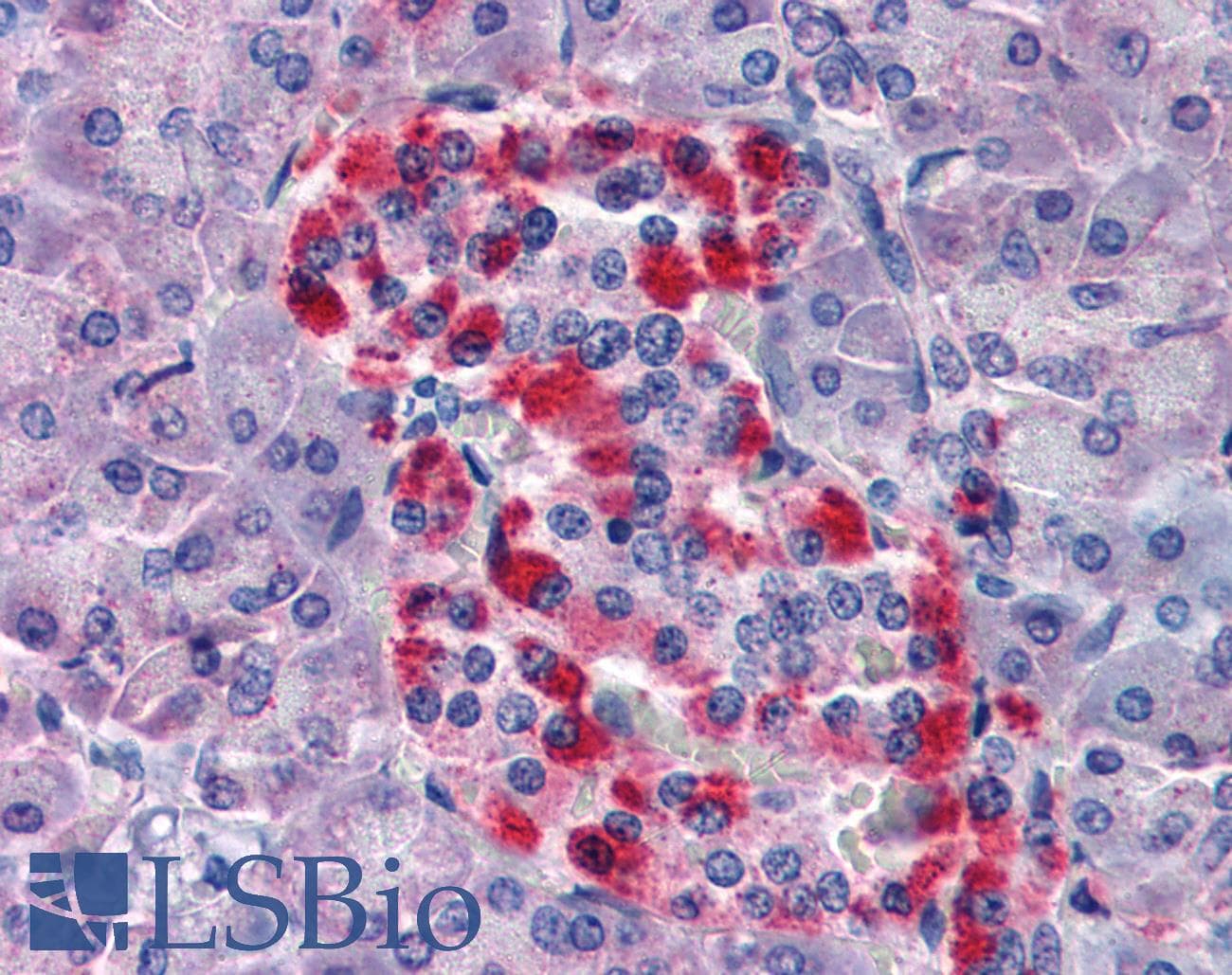 IHC-plus™ Polyclonal Rabbit anti-Human BID Antibody (IHC, WB)