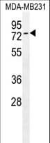 PARP7 / TIPARP Antibody (aa263-292)