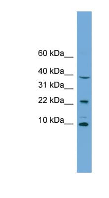 Polyclonal Rabbit anti-Human CHCHD8 Antibody (C-Terminus, WB)