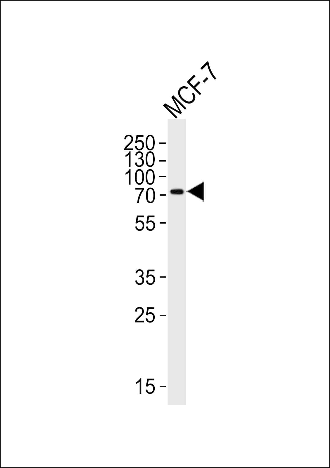 KLC2 Antibody (aa128-156)