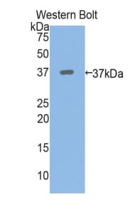PPL / Periplakin Antibody (aa1439-1716)