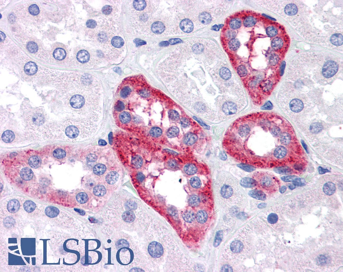 IHC-plus™ APH1A / APH-1 Antibody (aa58-70)