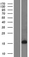 ZSCAN2 Protein (Over-Expression Lysate Myc-DDK (Flag))