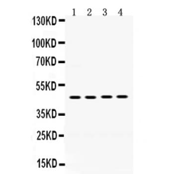 Polyclonal Rabbit anti-Human F2R / Thrombin Receptor / PAR1 Antibody (aa46-82, IHC, WB)