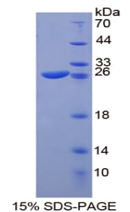 Rat SP100 Protein (Recombinant His-T7)