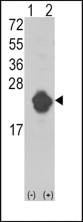 IL1RN Antibody (aa100-129)