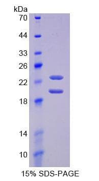 Mouse FGF2 / Basic FGF Protein (Recombinant His-T7)