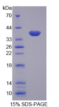 Human TNFAIP3 / A20 Protein (Recombinant His-T7)