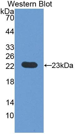 VHL / Von Hippel Lindau Antibody (aa6-175, APC)
