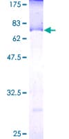 Human LGALS8 / Galectin 8 Protein (Recombinant GST)