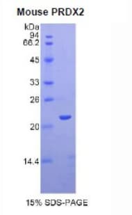 Mouse PRDX2 / Peroxiredoxin 2 Protein (Recombinant His)