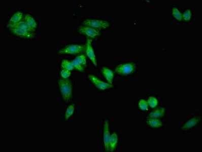 APOH / Apolipoprotein H Antibody