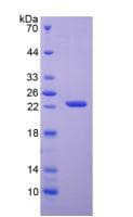 Human APRT Protein (Recombinant His, N-Terminal)