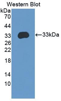 ITGB4 / Integrin Beta 4 Antibody (aa1098-1356)
